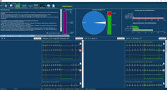 Logiciel Holter ECG : Lifescreen Pro